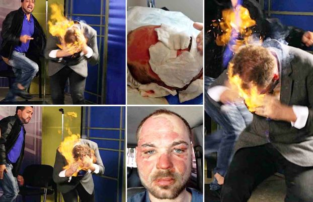 Wajah Pesulap Dibakar oleh Presenter TV